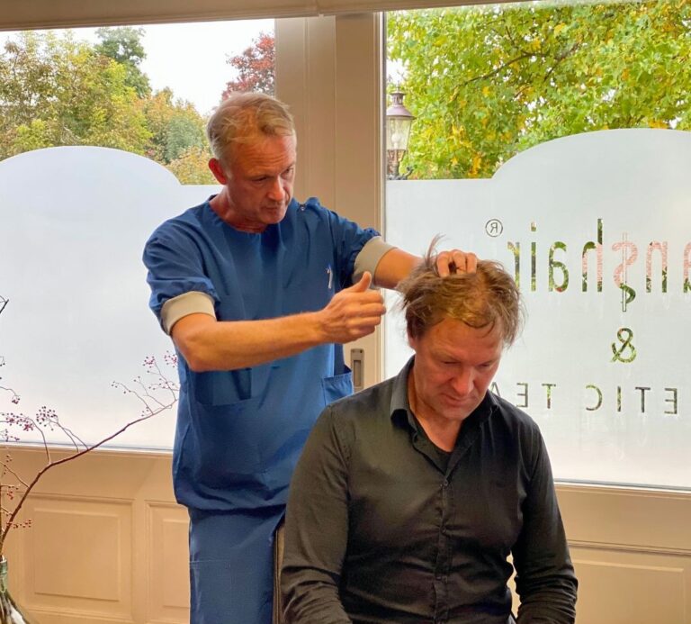 haartransplantatie arts