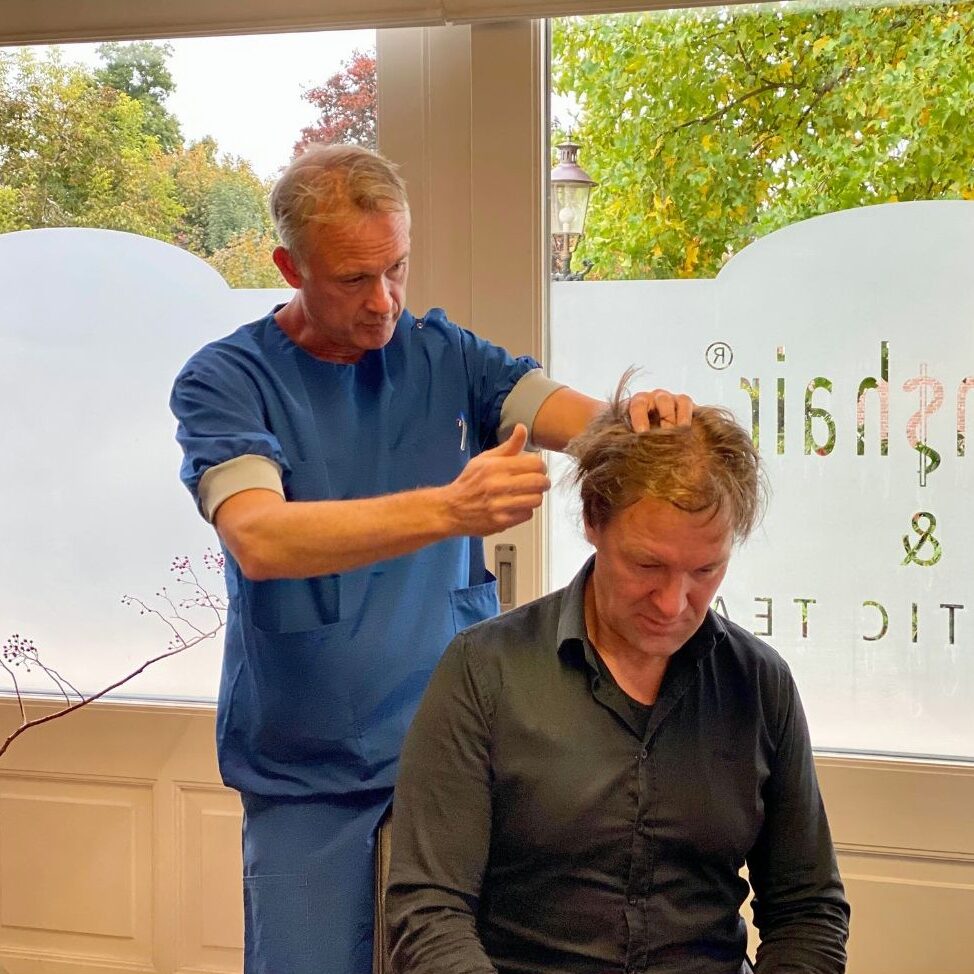 haartransplantatie arts